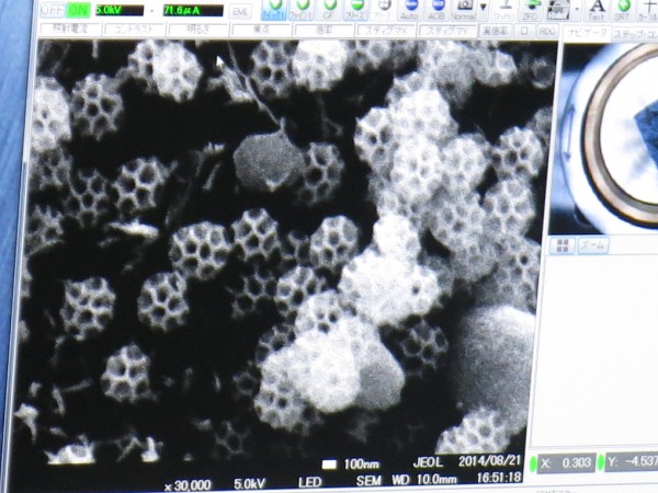 図５：観察されたSEM画像―オオヨコバイのブロコソーム